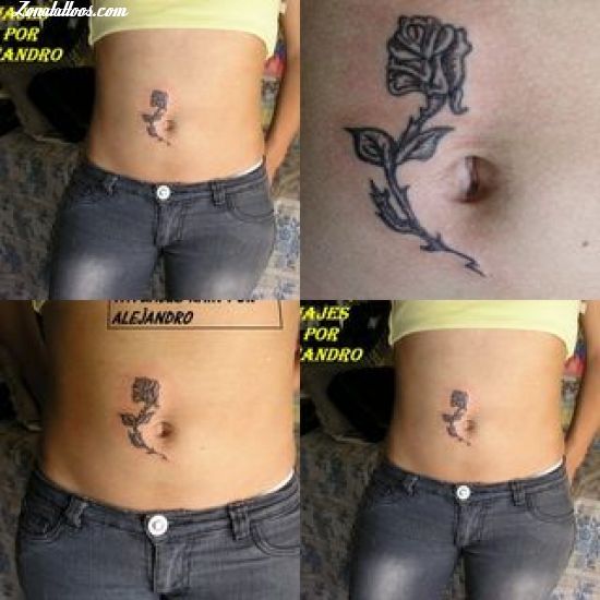 Medical Scar Camouflage Tattoo Treatment in CT Call NOW